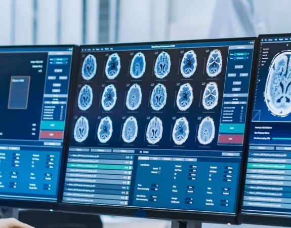Medical - NDE Medical - NDE